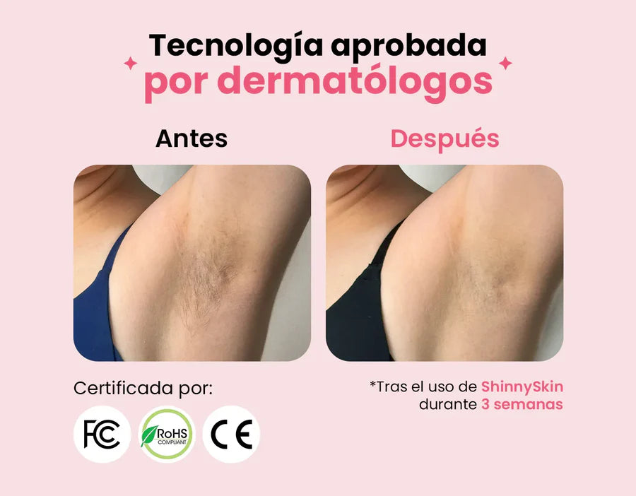 Depiladora permanente IPL ShinnySkin™